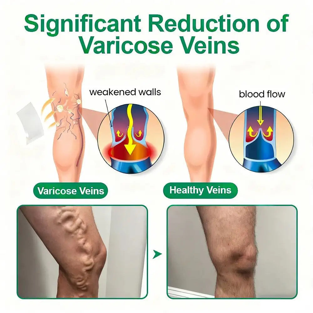 🗽👩‍⚕️Clearena® VeinTarget Microneedle Patch⚡Instant Relief, Long-Term Results